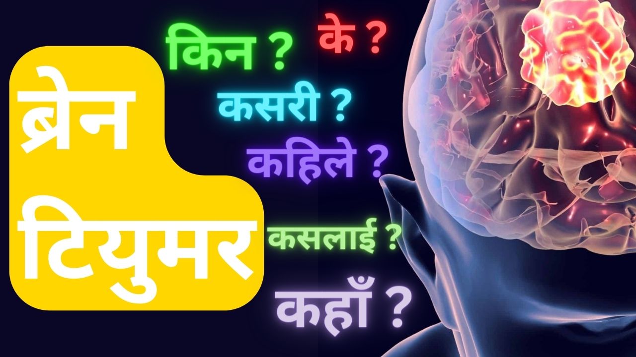 ब्रेन टयुमर के हो ? प्रोफेसर डाक्टर अमित यसो भन्नु हुन्छ ।